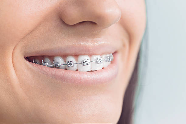 Best Invisalign and Clear Aligners  in Estill, SC